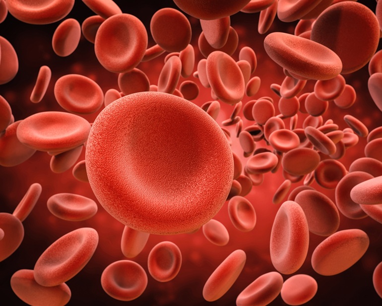 Anemia